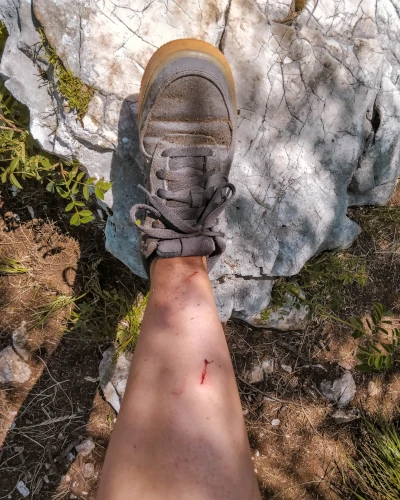 One of my legs after wandering around off-trail